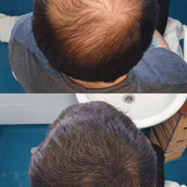 Free Sample 7g bottle - 15 day supply