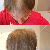 Free Sample 7g bottle - 15 day supply