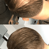 Free Sample 7g bottle - 15 day supply