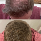 Free Sample 7g bottle - 15 day supply