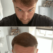 Free Sample 7g bottle - 15 day supply