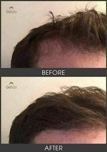 Gofybr 84g Hair Thickening Fibres Instant Results - 180 day supply