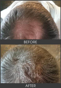 Gofybr 28g Hair Thickening Fibres Instant Results - 60 day supply