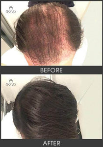 Gofybr 28g Hair Thickening Fibres Instant Results - 60 day supply