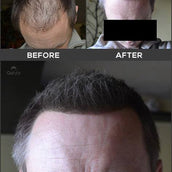 Gofybr 28g Hair Thickening Fibres Instant Results - 60 day supply