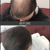 Gofybr 28g Hair Thickening Fibres Instant Results - 60 day supply